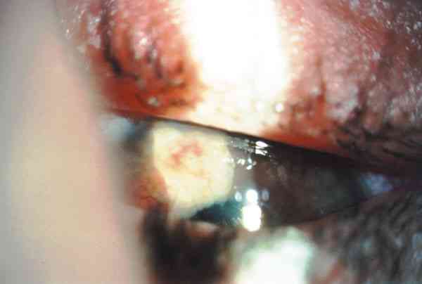 f13-01.jpg (36107 bytes)