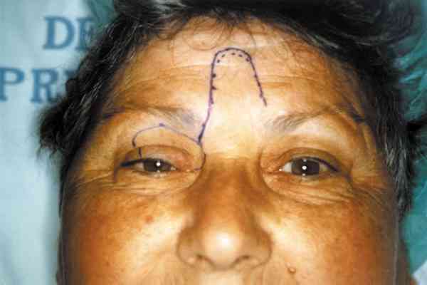 f14-01.jpg (51357 bytes)