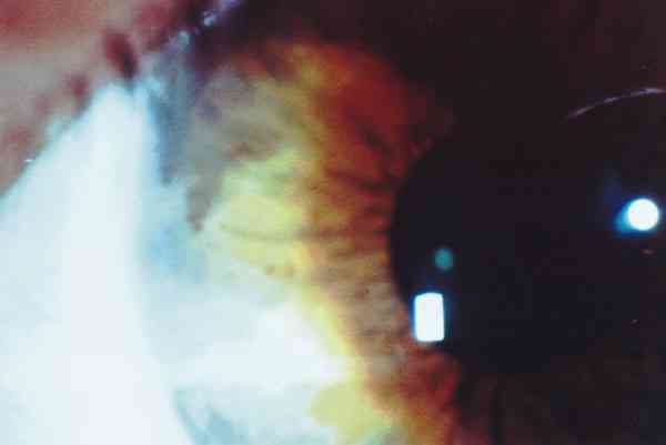 f15-02.jpg (27811 bytes)