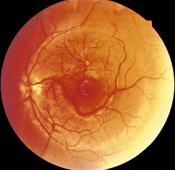 f15-03.jpg (63367 bytes)