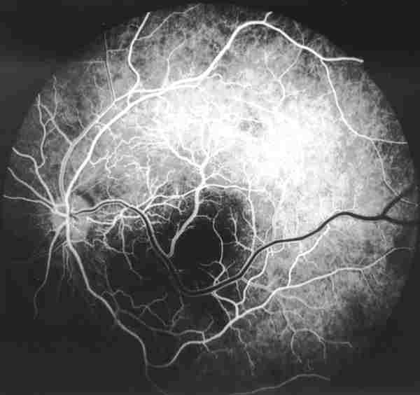 f15-04.jpg (58141 bytes)