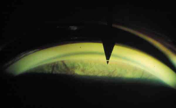 f11-01.jpg (22754 bytes)