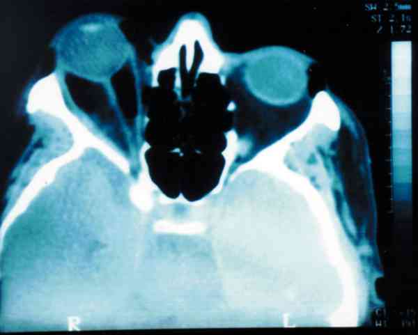 f08-01.jpg (55130 bytes)