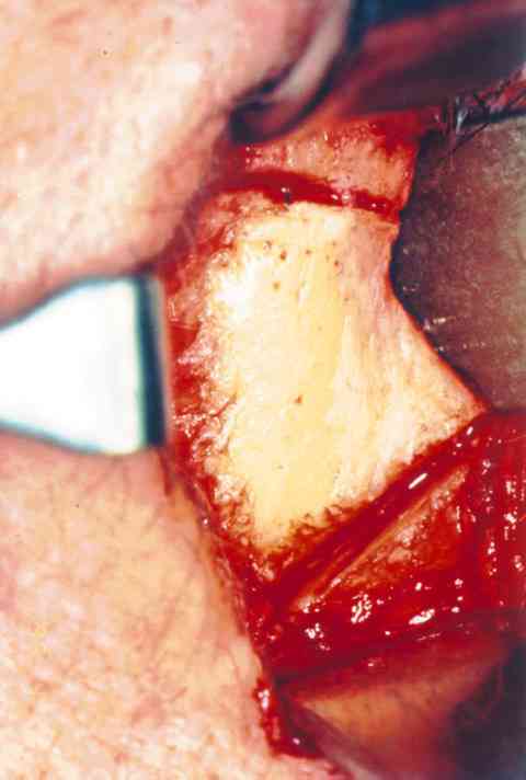 f08-02.jpg (81031 bytes)