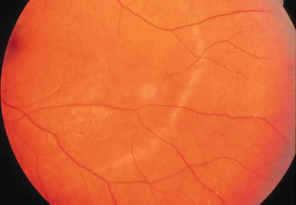 f15-13.jpg (33403 bytes)