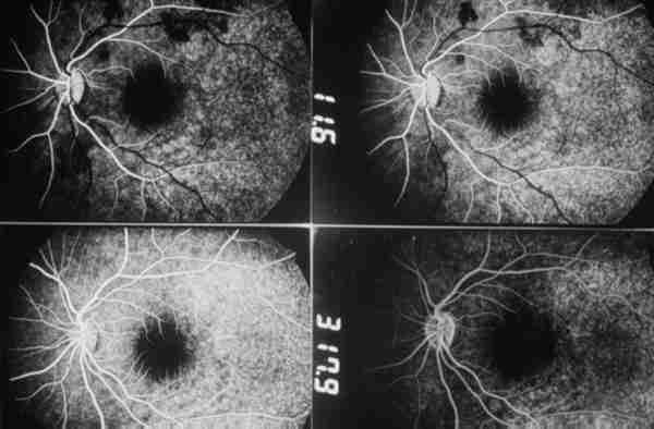 f15-14.jpg (69207 bytes)